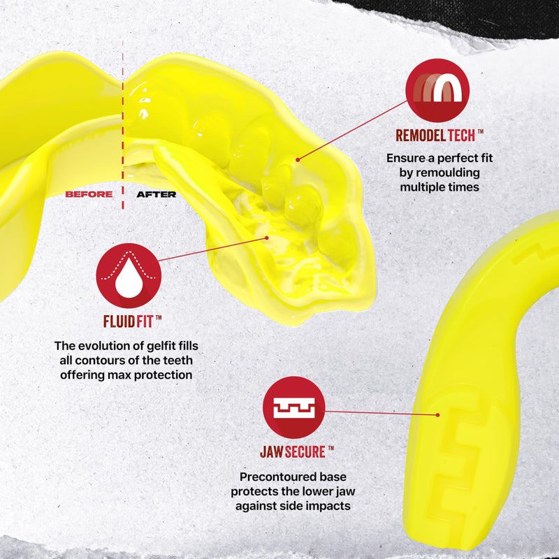SAFEJAWZ Sports Mouthguard Slim Fit, Adult and Junior Mouth Guard with Case for Boxing, Basketball, Lacrosse, Football, MMA, Martial Arts, Hockey and All Contact Sports (Adult 12+ Years, Yellow) - Image 3